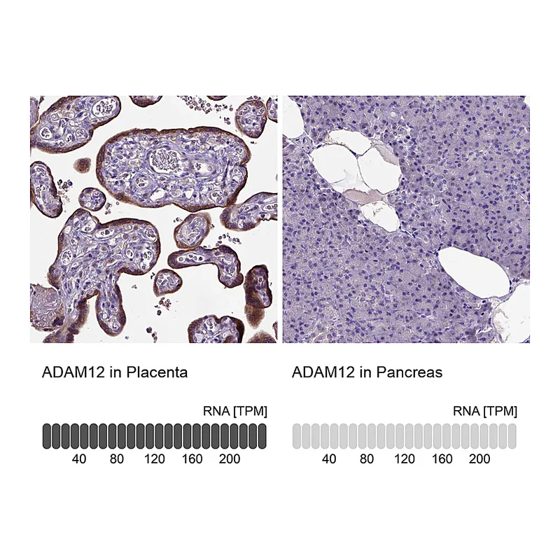 Atlas Antibodies Anti-ADAM12 Antibody