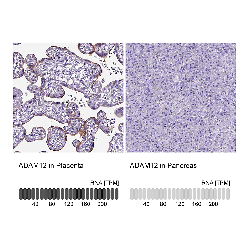 Atlas Antibodies Anti-ADAM12 Antibody