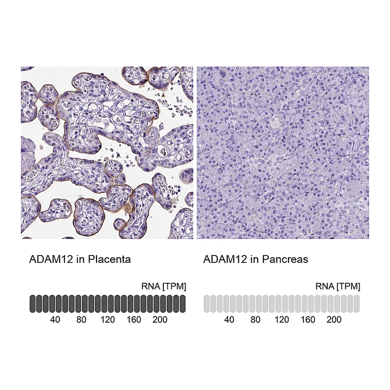 Atlas Antibodies Anti-ADAM12 Antibody