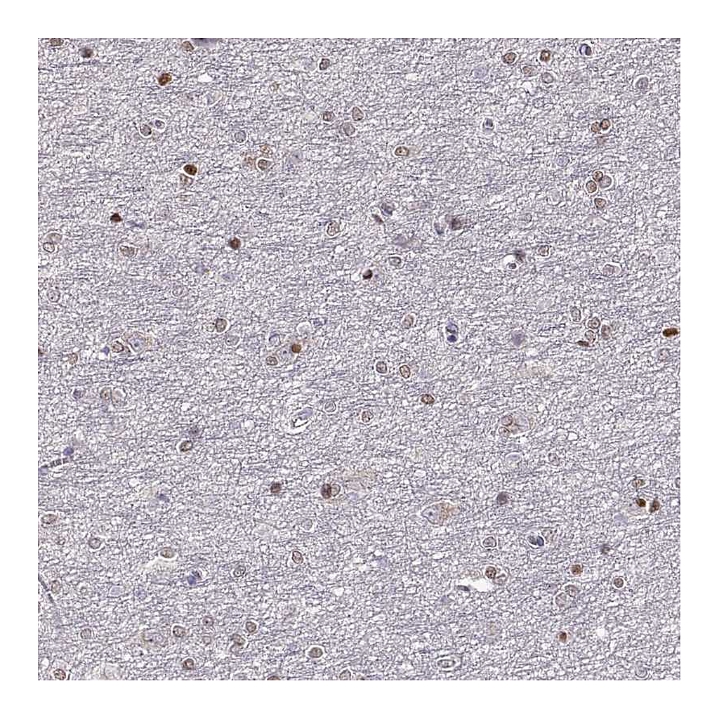 Atlas Antibodies Anti-ADAM11 Antibody