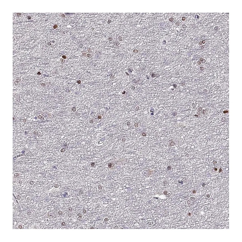 Atlas Antibodies Anti-ADAM11 Antibody