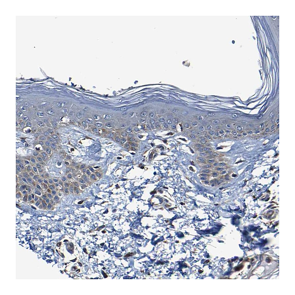 Atlas Antibodies Anti-ADAM15 Antibody