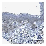 Atlas Antibodies Anti-ADAM15 Antibody