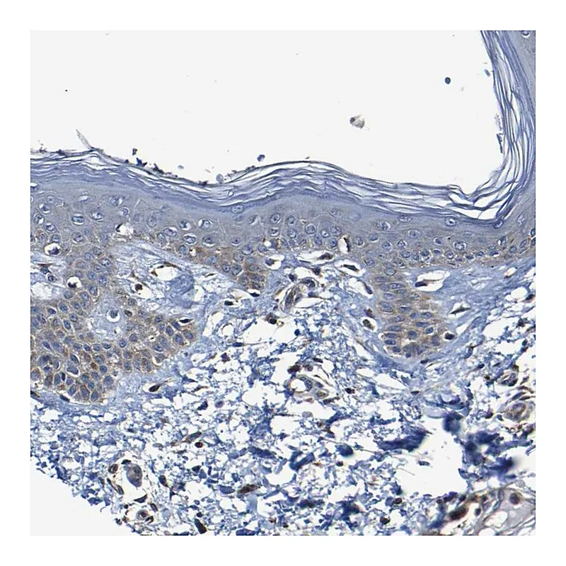 Atlas Antibodies Anti-ADAM15 Antibody