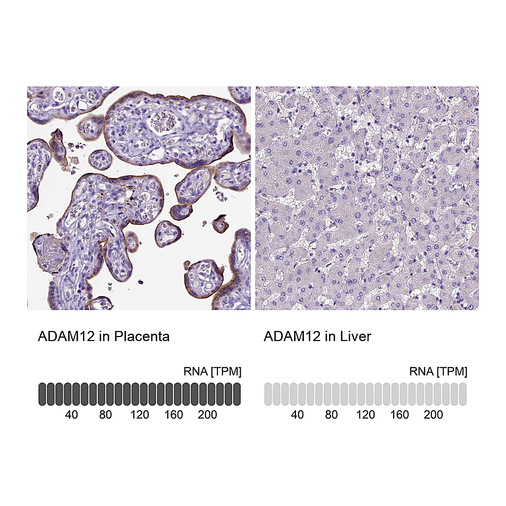 Atlas Antibodies Anti-ADAM12 Antibody