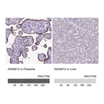 Atlas Antibodies Anti-ADAM12 Antibody