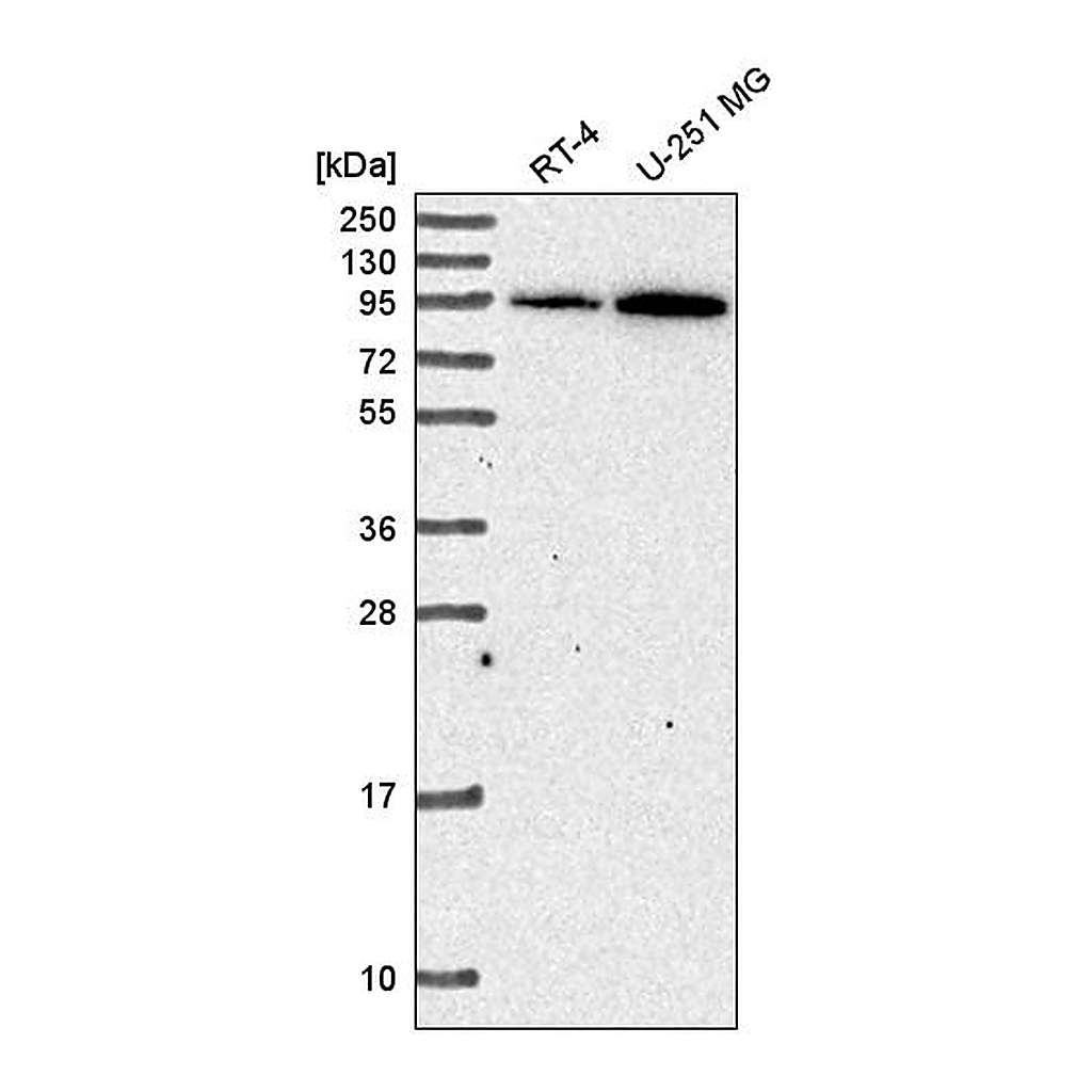 Atlas Antibodies Anti-ADAM17 Antibody