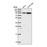 Atlas Antibodies Anti-ADAM17 Antibody