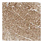 Atlas Antibodies Anti-ADAM17 Antibody