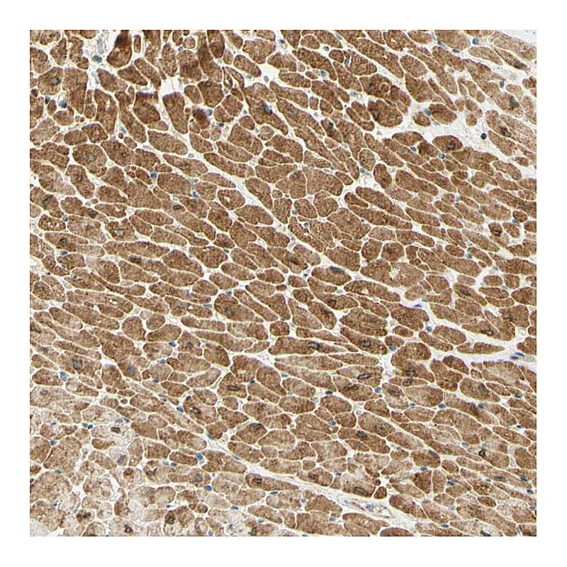 Atlas Antibodies Anti-ADAM17 Antibody