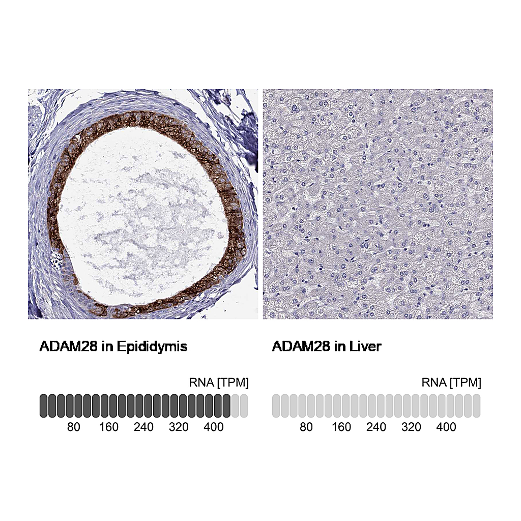 Atlas Antibodies Anti-ADAM28 Antibody