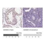 Atlas Antibodies Anti-ADAM20 Antibody