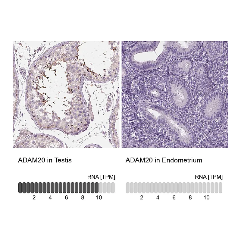 Atlas Antibodies Anti-ADAM20 Antibody