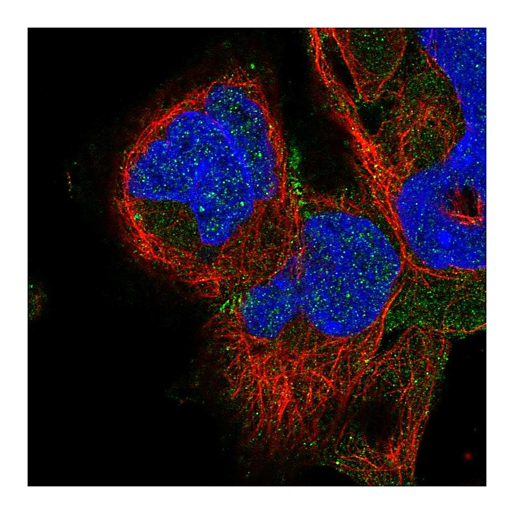 Atlas Antibodies Anti-ADAM22 Antibody