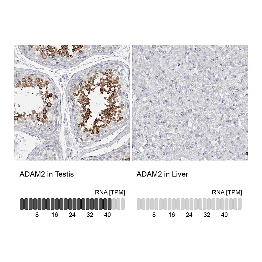 Atlas Antibodies Anti-ADAM2 Antibody