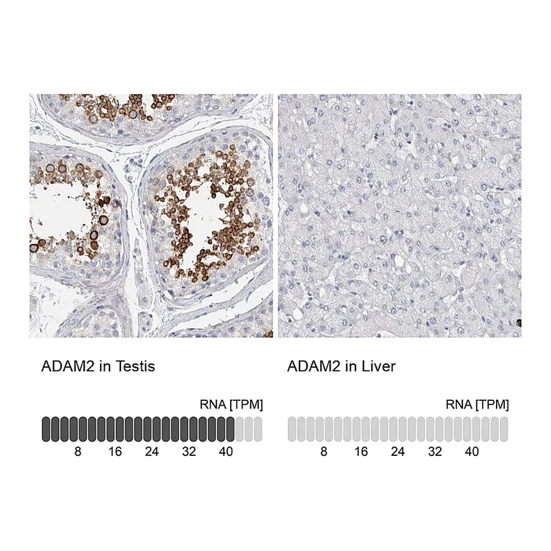 Atlas Antibodies Anti-ADAM2 Antibody
