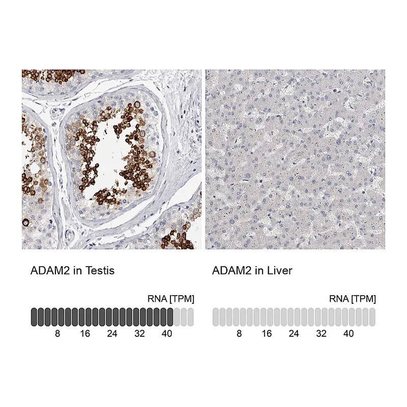 Atlas Antibodies Anti-ADAM2 Antibody