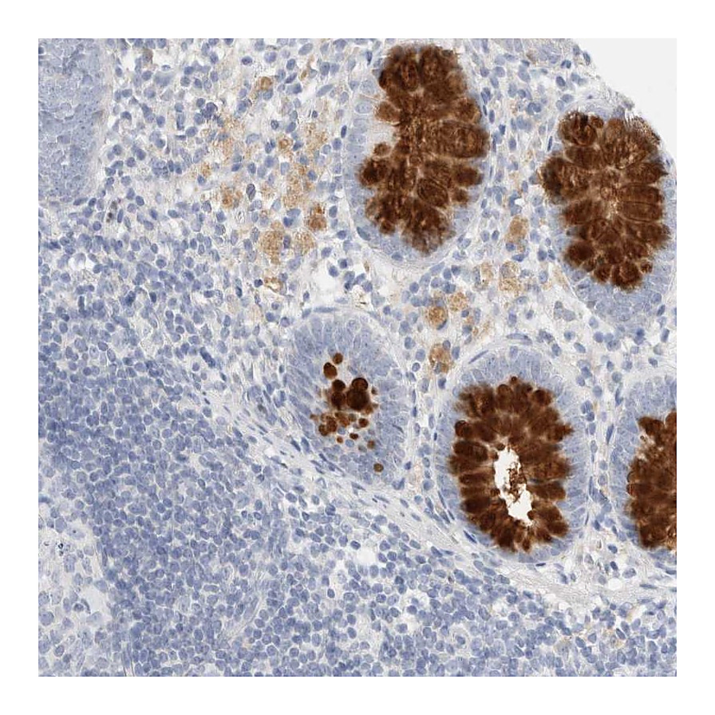 Atlas Antibodies Anti-ADAM30 Antibody