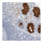 Atlas Antibodies Anti-ADAM30 Antibody