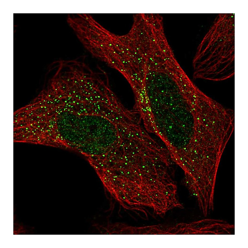 Atlas Antibodies Anti-ADAM32 Antibody