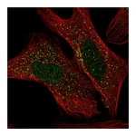 Atlas Antibodies Anti-ADAM32 Antibody