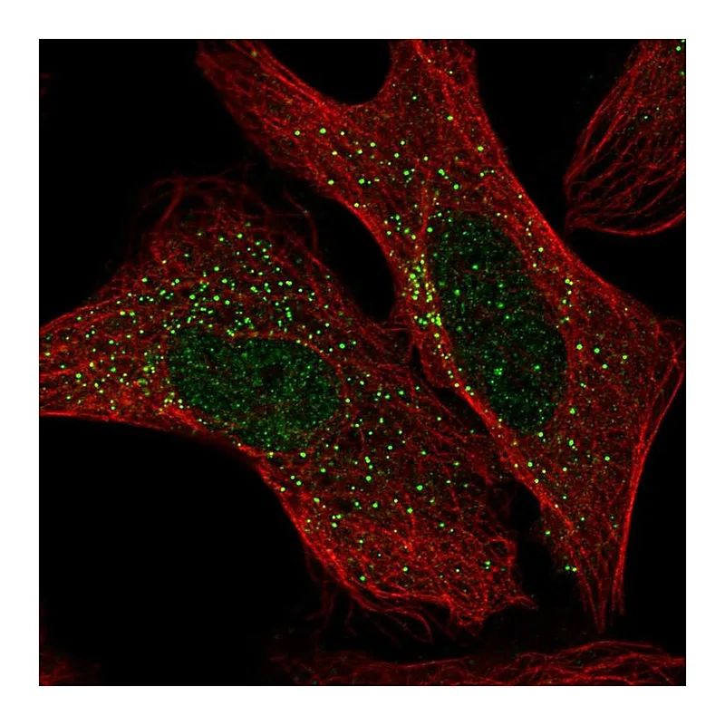 Atlas Antibodies Anti-ADAM32 Antibody
