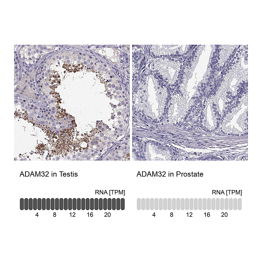 Atlas Antibodies Anti-ADAM32 Antibody