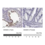 Atlas Antibodies Anti-ADAM32 Antibody
