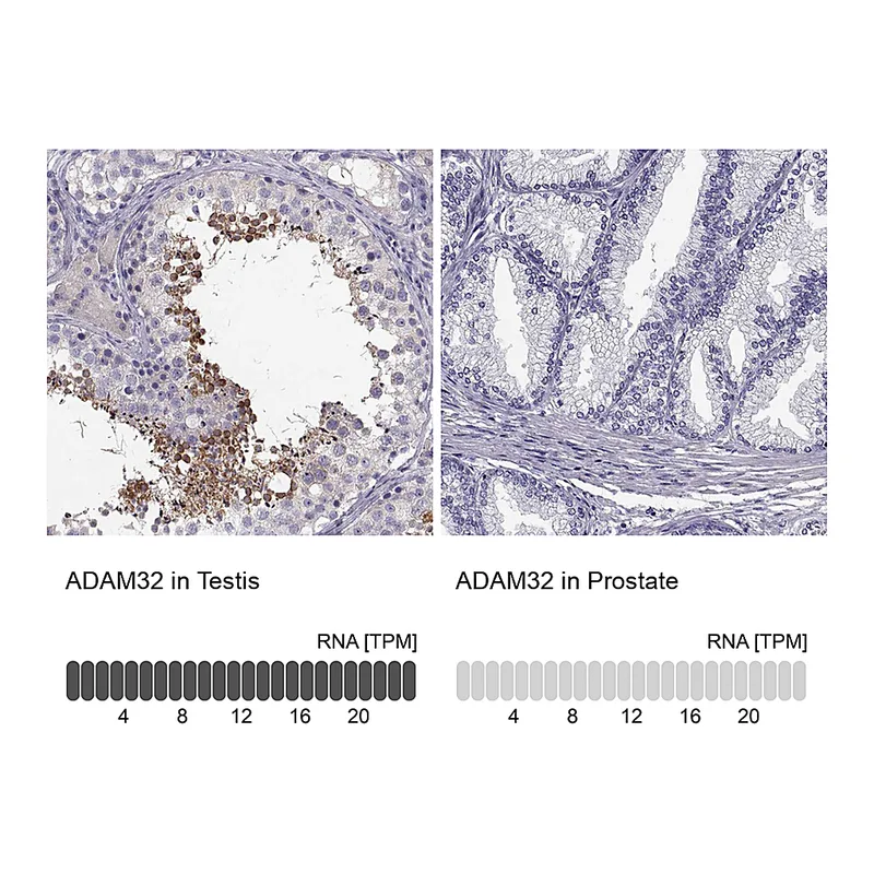 Atlas Antibodies Anti-ADAM32 Antibody