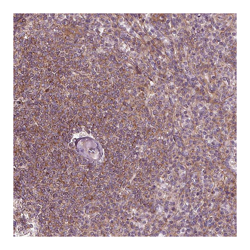 Atlas Antibodies Anti-ADAM33 Antibody