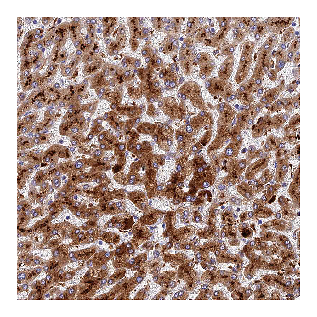 Atlas Antibodies Anti-ADAMTS13 Antibody