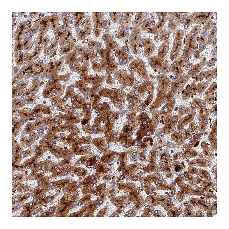 Atlas Antibodies Anti-ADAMTS13 Antibody