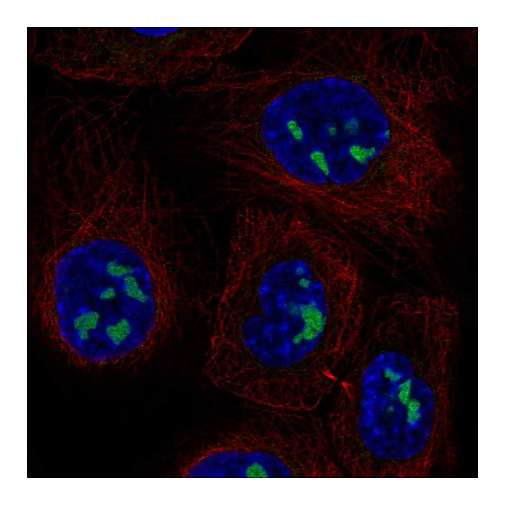 Atlas Antibodies Anti-ADAMTS12 Antibody