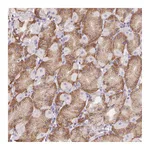 Atlas Antibodies Anti-ADAM8 Antibody