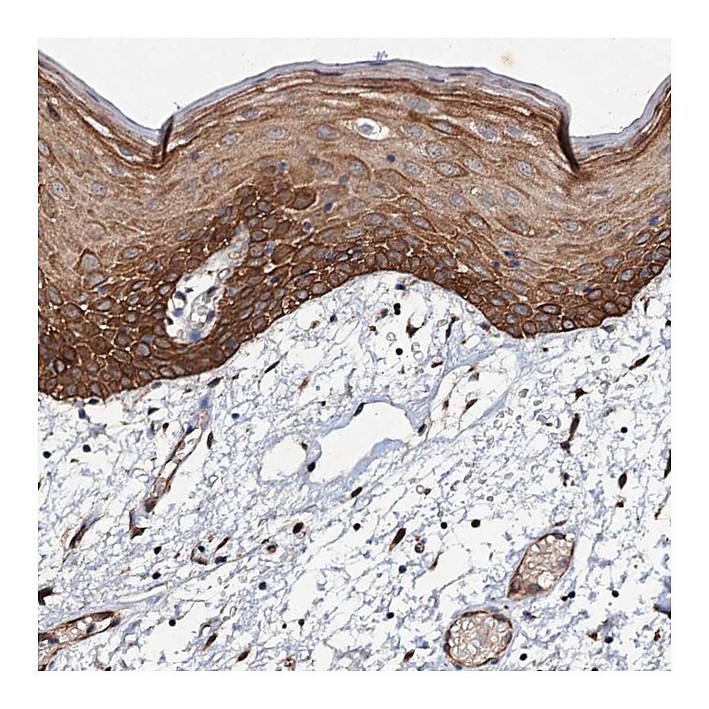 Atlas Antibodies Anti-ADAMTS10 Antibody