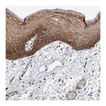 Atlas Antibodies Anti-ADAMTS10 Antibody