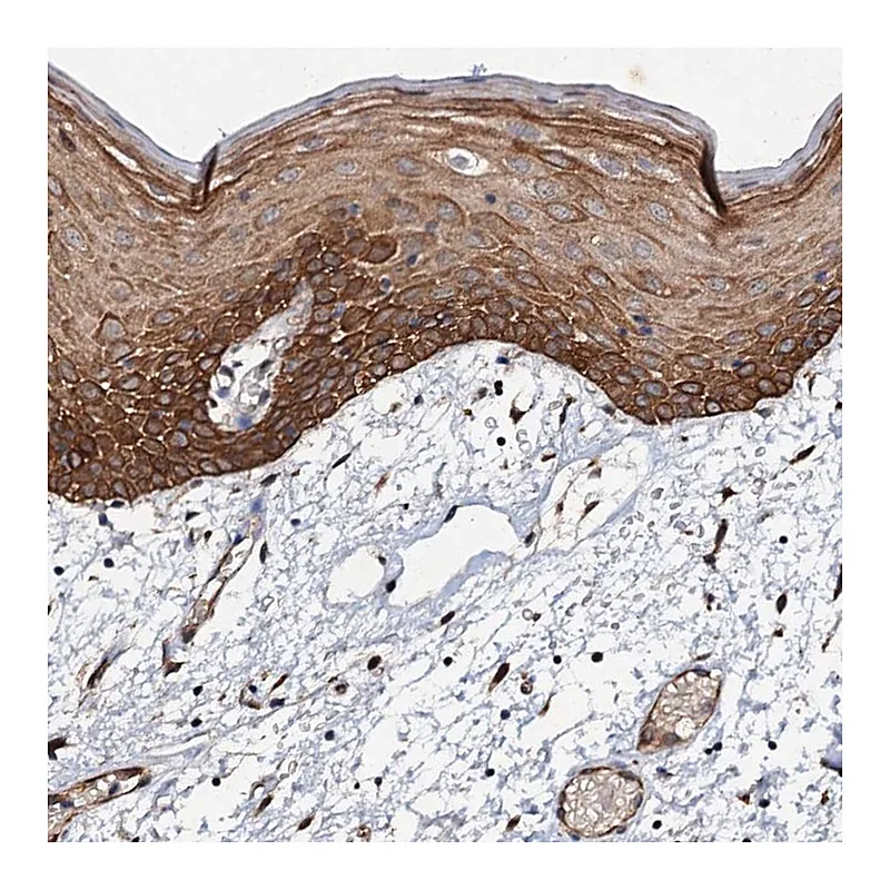 Atlas Antibodies Anti-ADAMTS10 Antibody
