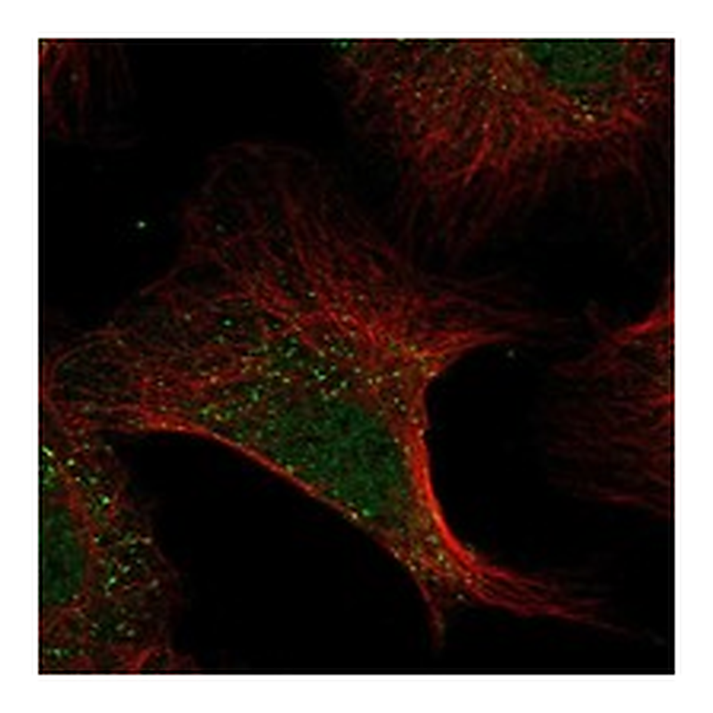 Atlas Antibodies Anti-ADAMTS13 Antibody