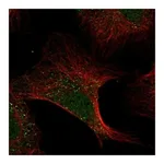 Atlas Antibodies Anti-ADAMTS13 Antibody