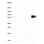 Atlas Antibodies Anti-ADAMTS16 Antibody