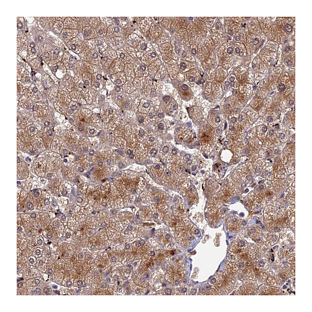 Atlas Antibodies Anti-ADAMTS13 Antibody