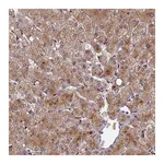 Atlas Antibodies Anti-ADAMTS13 Antibody