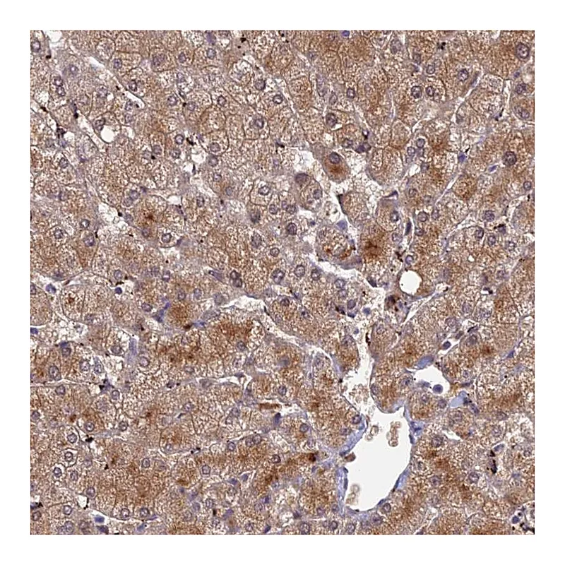 Atlas Antibodies Anti-ADAMTS13 Antibody