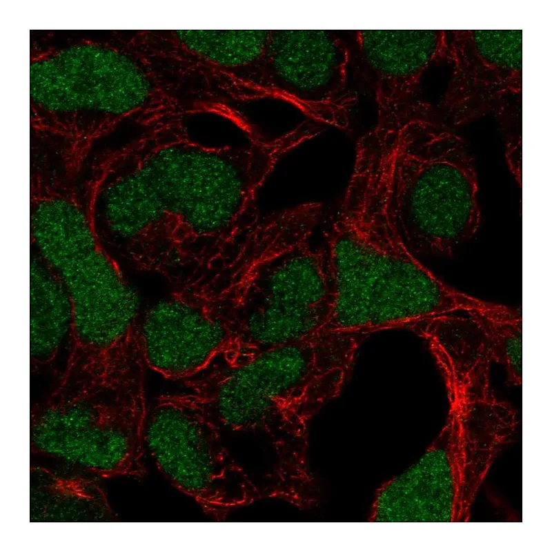 Atlas Antibodies Anti-ADAMTS17 Antibody