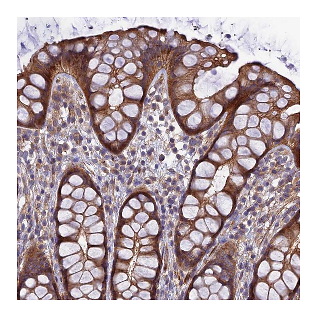 Atlas Antibodies Anti-ADAMTS15 Antibody