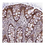 Atlas Antibodies Anti-ADAMTS15 Antibody