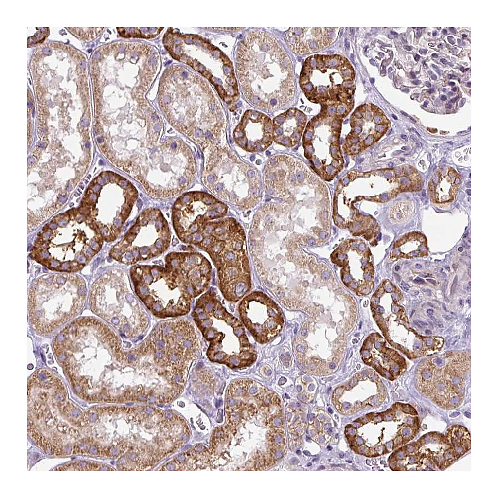 Atlas Antibodies Anti-ADAMTS19 Antibody
