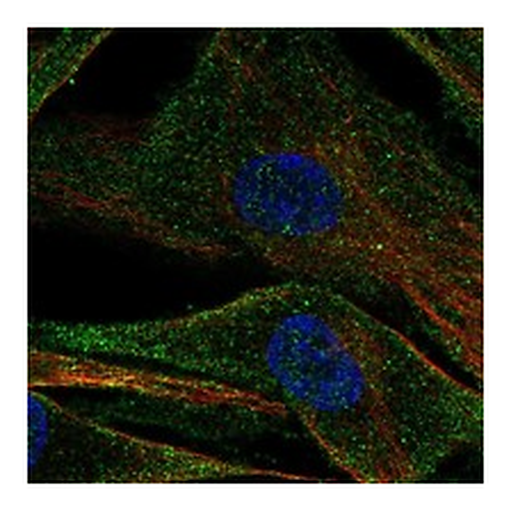 Atlas Antibodies Anti-ADAMTS2 Antibody