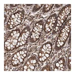 Atlas Antibodies Anti-ADAMTS20 Antibody