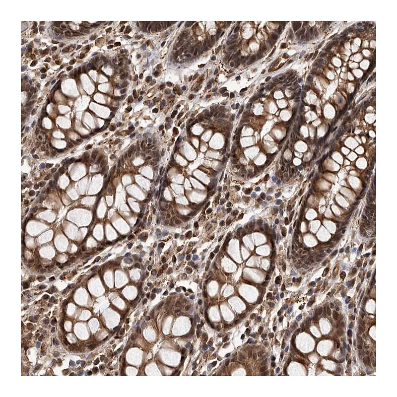 Atlas Antibodies Anti-ADAMTS20 Antibody